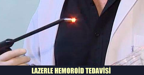 Lazerle Hemoroid Tedavisi